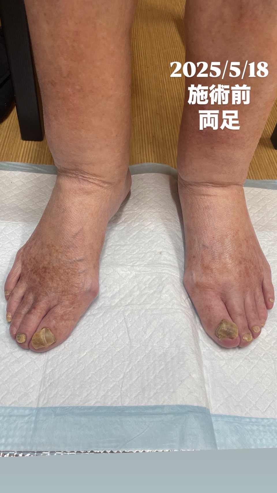 施術前に足の状態を確認する様子